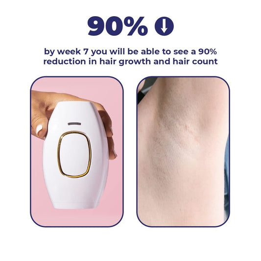 Syleca Portable IPL Hair Remover