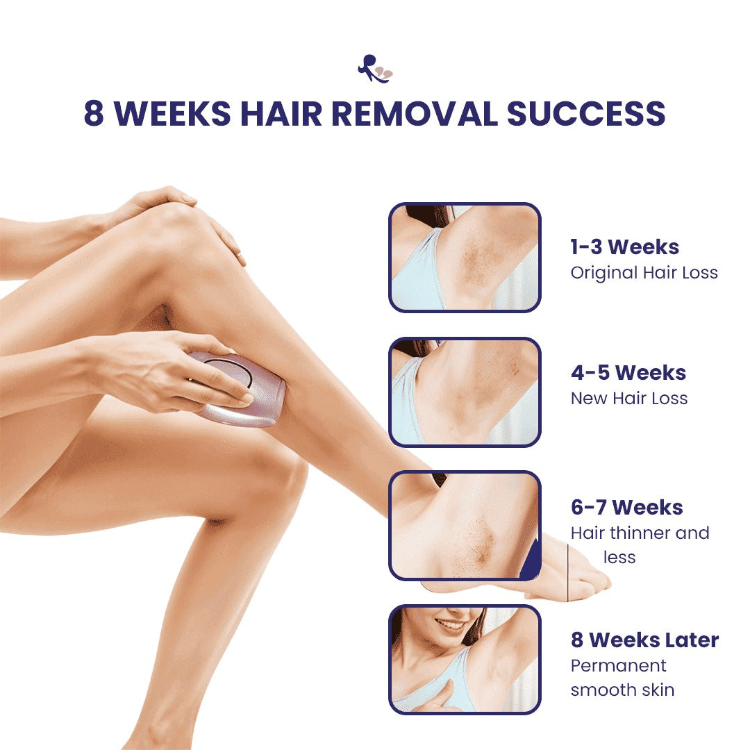 Syleca Portable IPL Hair Remover
